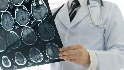 O trabalho tem como objetivo analisar de forma abrangente o perfil de estagiários de neurologia vascular no Brasil (Foto: Getty Images)