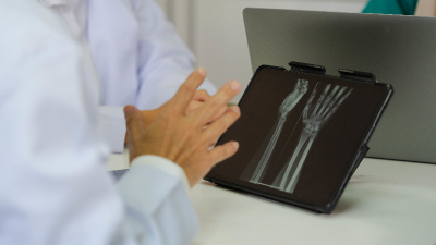 Pesquisadores desenvolveram um aplicativo que integra uma inteligência artificial treinada para estimar a idade óssea a partir de radiografias da mão e do punho (Ilustração: Getty Images)