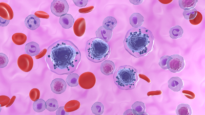 A leucemia é a décima neoplasia mais presente no Brasil (Ilustração: Getty Images)