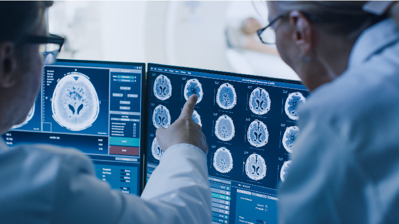 O estudo visa aplicar descobertas científicas básicas na prática clínica, como o desenvolvimento de novos agentes terapêuticos com ação neuroprotetora (Ilustração: Getty Images)