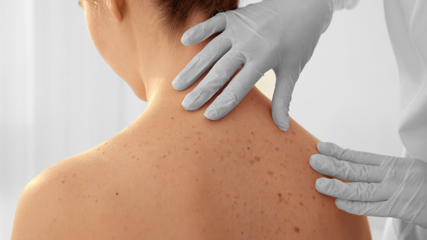 Especialização Em Fisioterapia Dermatofuncional - Pós-Graduação